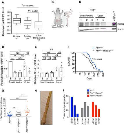 Figure 1. RasGRP1 acts as a tumor suppressor in ApcMin(and compared with pendent experiments (Kaplan-Meier curves of pendent experiments