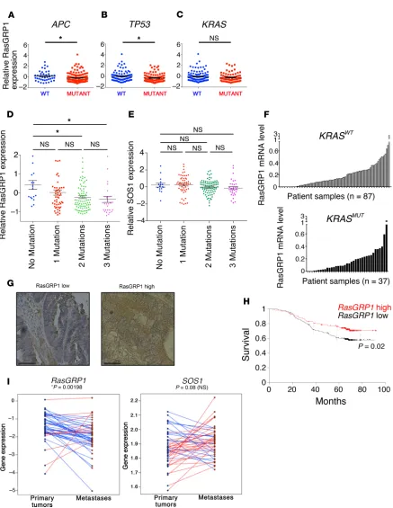 Figure 3. RasGRP1 is a prognostic marker for CRC. (SOS1level, respectively. Student’s Expression of RasGRP1 in patients with WT versus mutant A–C) RasGRP1 expression in human CRC patients from the TCGA Colorectal Adenocarcinoma data sets