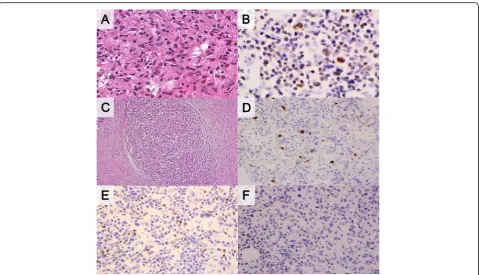 Table 3 Diagnostic utility of pathologic markers in mediastinal B-cell lymphomas