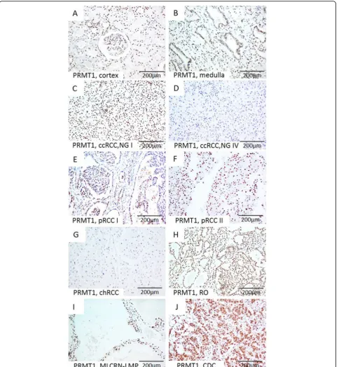 Fig. 1 Representative microscopic photographs of PRMT1 expression in non-tumor renal parenchyma (a-b) and various RCT (c-j)