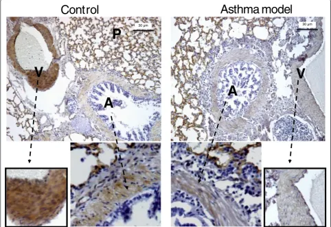 Figure 5 Determination of caveolin-1 expression in control and asthma model guinea pigs by immunohistochemistry