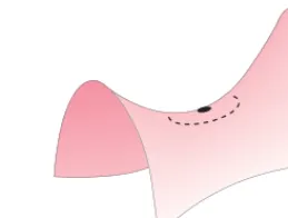 FIGURE 33–18 Example of a 