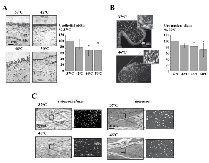 Figure 4.  The effect of heating on tissue structure.     A: Sections of bladder wall (H&amp;E stained) at 37, 42, 46 and 50°C