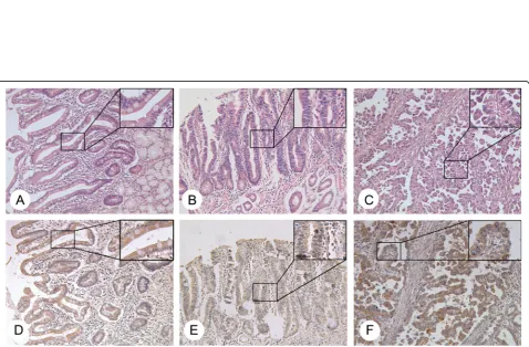 Fig. 2 GCRG213p expression in human normal gastric mucosa. Serial sections from the same block of normal gastric fundic mucosa were stainedby immunohistochemistry with GCRG213p antibody (the upper row) and H&E (the lower row)