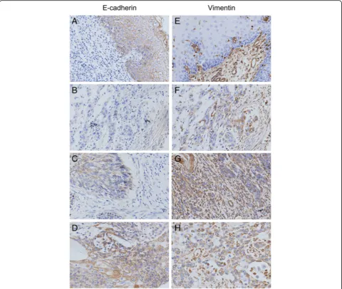 Table 2 The expression of E-cadherin and Vimentin in Kazakh esophageal ESCC CANs