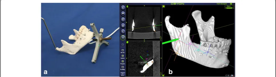 Fig. 3 The registration process using Cbyon navigation system. a registration in the mandibular model