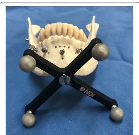 Fig. 6 Registration within 3D Slicer with Polaris optical tracker. a registration in the mandibular model