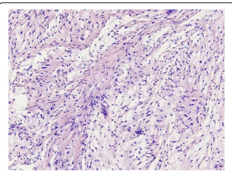 Fig. 1 Representative photomicrograph of heamatoxylin and eosine(H&E)-stained section of a cellular intramuscular myxoma showing itscharacteristic histological morphology