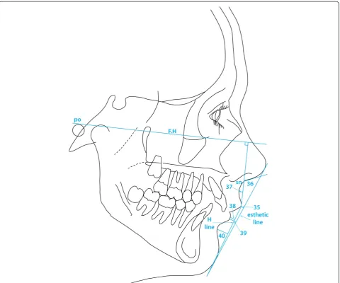 Figure 8 Angles and linear measurements used to describe lip position and profile (Holdaway [22,23])