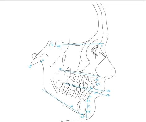 Figure 1 The cephalometric reference points used in the present study (Björk analysis).
