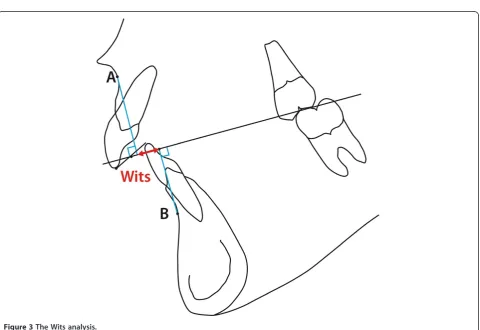 Table 2 Comparison of results of the cephalometric analysis of skeletal, dento-alveolar and soft tissue factors of thePolish study material compared to the control group (Björk)