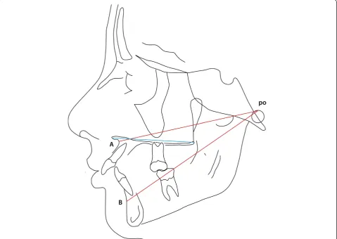 Figure 4 Linear expression maxillary and mandibular length/prognathism relative to the point porion (po) (var