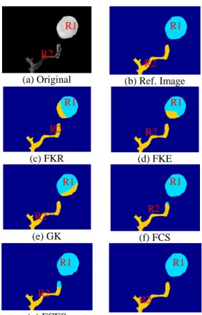 Fig. 3:  (a) Original sun image, (b) Manually  segmented reference of (a). Fig. (c) – (h) the  segmented results using FKR, FKE, GK, FCS,  FCES, and FCGS respectively