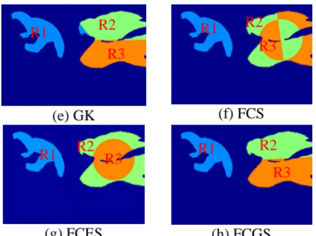 Fig. 4:  (a) Original bird image, (b) Manually  segmented reference of (a). Fig. (c) – (h) the  segmented results of (a) using FKR, FKE, GK, 