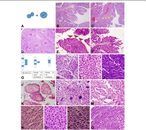 Fig. 1 (1) Representative images of histological parameters evaluated in this study.hyperchromasia.of the tumor cells of about 20-fold.2.of umbrella cells