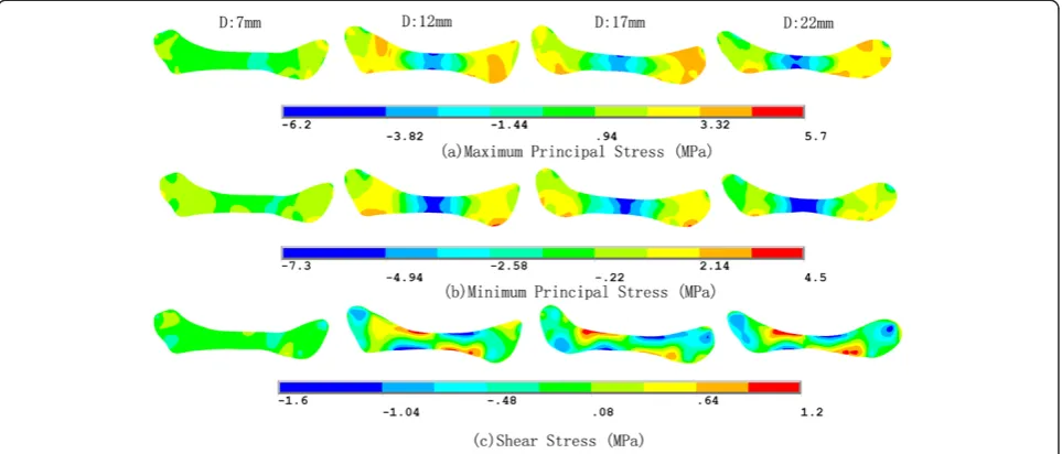Figure 5 Stress distribution of the disc at jaw opening of 7, 12, 17 and 22 mm (MPa).