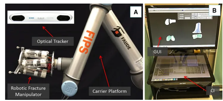Fig. 1 RAFS surgical system concept. The robotic fracture manipulator connected to the carrier platform, and the optical tracker (a); the systemworkstation running the GUI and the CI (b)