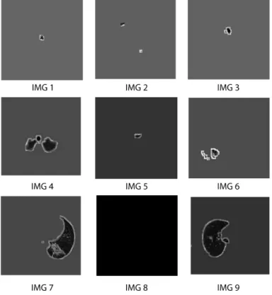 Figure 8 Segmented images