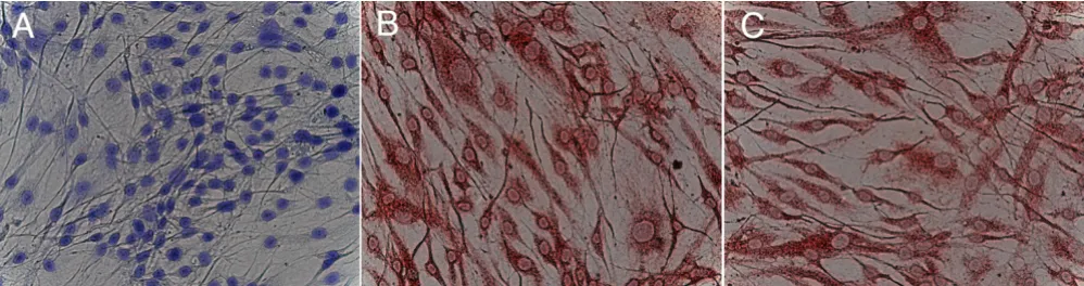 Figure 1Immunhistochemical staining of cultured human MSCImmunhistochemical staining of cultured human MSC
