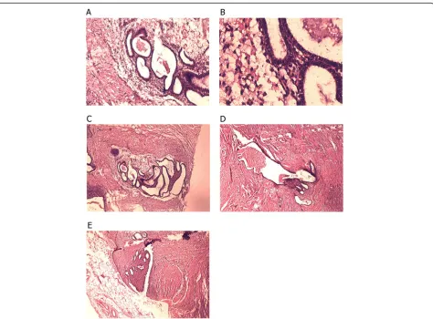 Figure 1 Histopathological characteristics of endometriosis in different tissue types