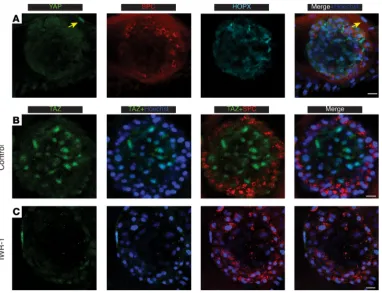 Figure 3. TAZ, but not YAP, is expressed (nuclear localized) during differentiation in AEC organoid culture