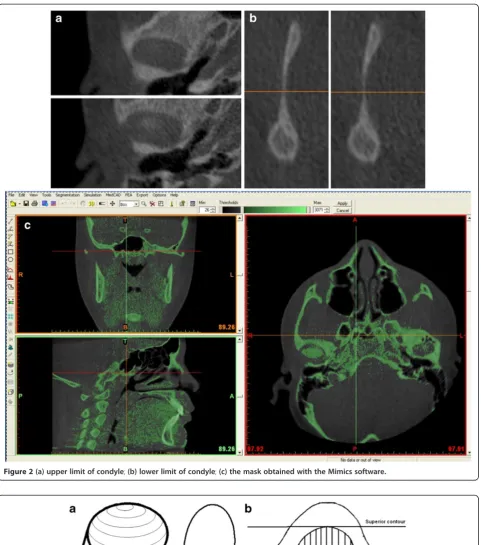 Figure 2 (a) upper limit of condyle; (b) lower limit of condyle; (c) the mask obtained with the Mimics software.