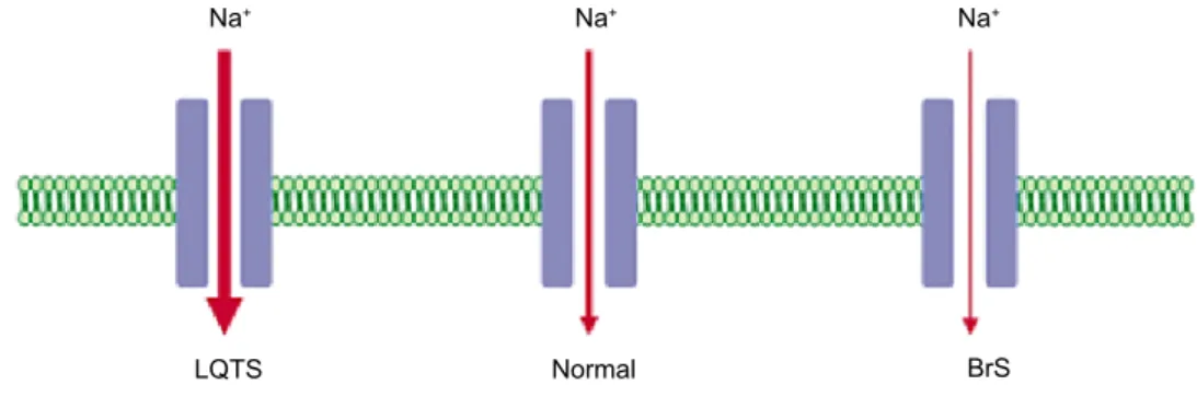Figure 1. Gain- and loss-of-function of the Na+ channels in long-QT syndrome and Brugada syndrome, with an increase and decrease in  cardiac I Na  current, respectively.