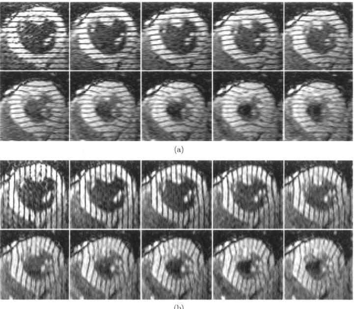 Fig. 6. A planar tagged image sequence with (a) horizontal and (b) vertical tags showing the short-axis of the LV in systole.