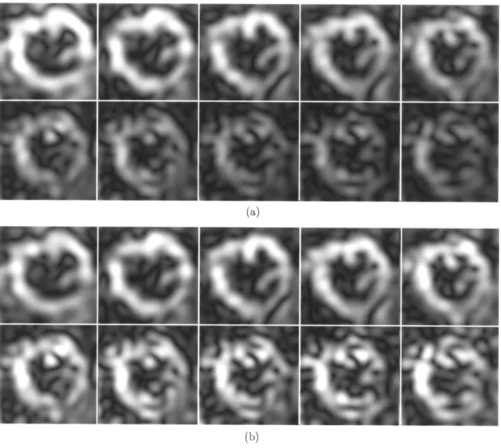 Fig. 7. (a) Average magnitude of the complex images computed from the tagged images in Fig
