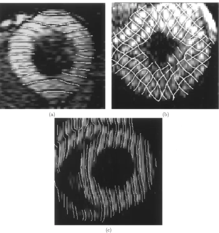 Fig. 9. Synthesized tag lines generated from (a) the first harmonic peak of this higher-order SPAMM-tagged image, (b) two diagonal angle images of this 2-D 1-1 SPAMM-tagged image, and (c) from the first harmonic peak this higher order SPAMM-tagged image of
