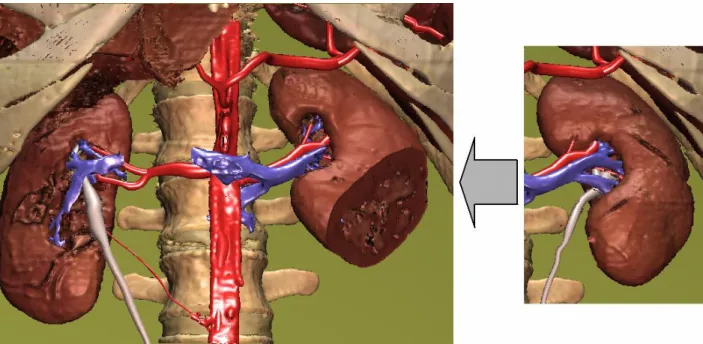 Figure 7: Volume based representation of shape variants of the left kidney in the VOXEL-MAN atlas