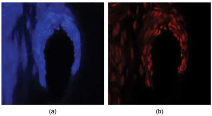 Fig. 7. Sample image showing (a) autofluorescence of the arterial wall and (b) endothelial nuclei (in red) at the same spatial location.
