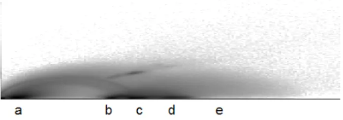 Figure 1 2D joint histogram of attenuation coefficient  versus  gradient  magnitude.  Regions  a)  –  e)  identify  different materials