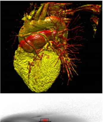 Figure  2  shows  a  volume  rendering  of  a  CT  scan  of  the  heart  and  the  transfer  functions  used