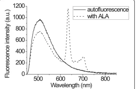 Figure 2 Scheme of the fluorescence spectroscopy system used for fluorescence photodetection of cervical lesions.