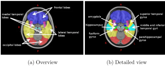 Figure 1.4: Axial views of the brain, showing the sub-structures of the medial temporal lobe.