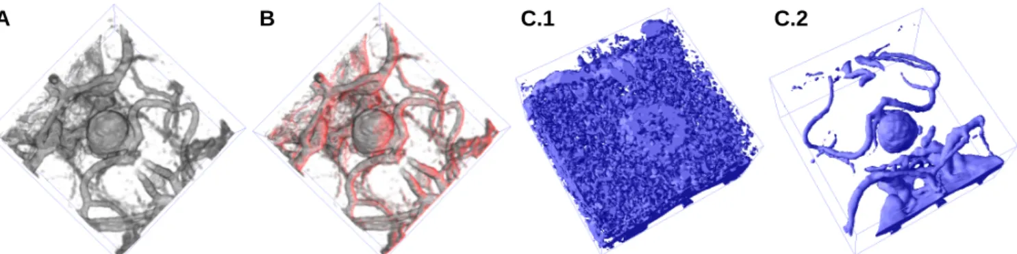 Figure 16: CTA aneurysm data set (128 2 × 64): (A) direct volume rendering without illumination, (B) direct volume rendering with red diffuse light source, (C) shaded isosurface for different isovalues.