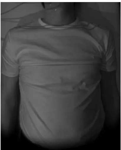 Figure 6. Example image from the NORM patient dataset. 