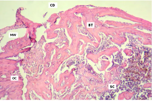 Figure 3Test group, day 15Test group, day 15. Surgical cavity (SC) with extensive centrifugal trabecular formation