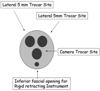 Figure 2.15: Schematic of SPA (adapted from the work by Rottman et al. (2010),under CC BY-NC-ND 3.0 license)