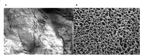 Figure 4 Collagen matrix, azan staining (100×): representative central area of pure collagen matrix.