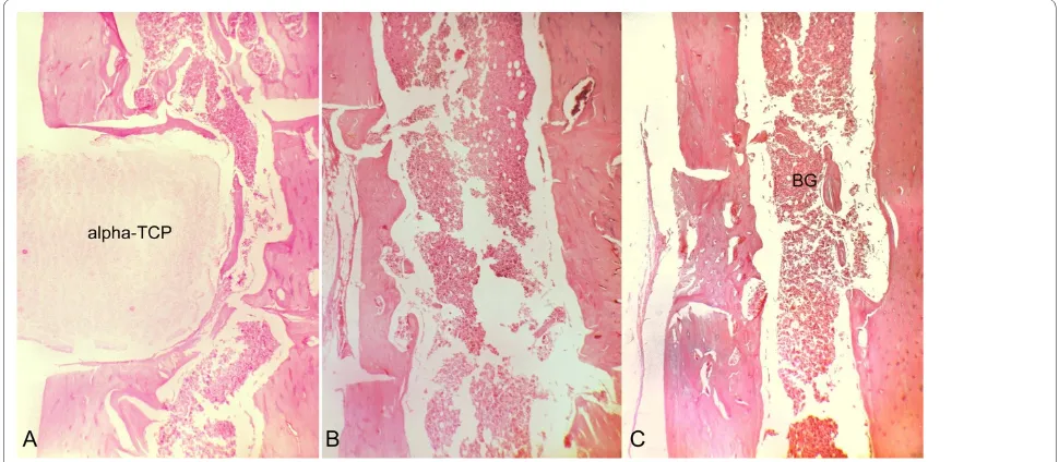 Figure 7 Histological aspects of samples collected on postoperative day 21. A, T cavity, The alpha-tricalcium phosphate (alpha-TCP) block occu-pies all the bone cavity