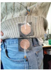 Fig. 4. Junction between two feed coils at the overlap of garments. 