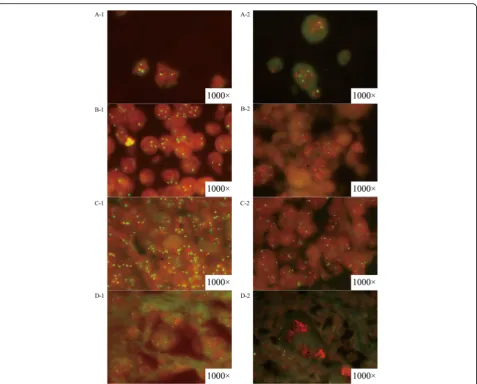 Fig. 2 The results of HER2 gene amplification status evaluated by FISH assay. A-1 was section of cell lines sample without HER2 gene amplification(MCF-7) while A-2 was that with positive HER2 gene amplification (SKBR-3)