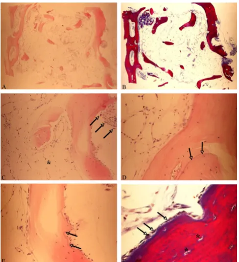Figure 5in H&E, B, and in Ladewig staining (both magnification × 25)Histologic sections of the sample A, Overview of the sample Histologic sections of the sample A, Overview of the sample in H&E, B, and in Ladewig staining (both magnification × 25)