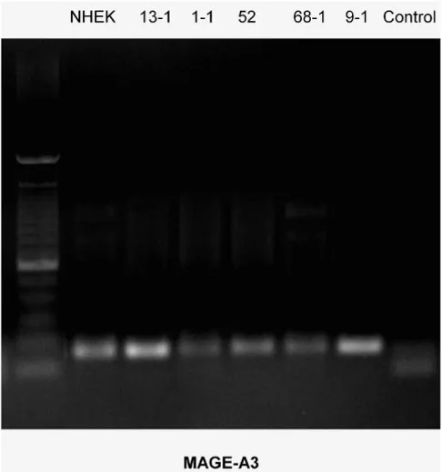 Figure 2inedRT-PCR-Blot of MAGE-A3 expression in the cell lines exam-RT-PCR-Blot of MAGE-A3 expression in the cell lines examined