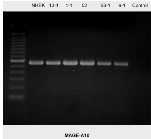 Figure 5examinedRT-PCR blot of MAGE-A10 expression in the cell lines RT-PCR blot of MAGE-A10 expression in the cell lines examined