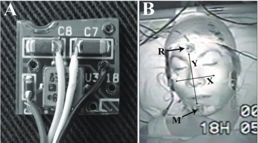 Figure 2 shows a block diagram of the data recording andanalyzing sequence is presented