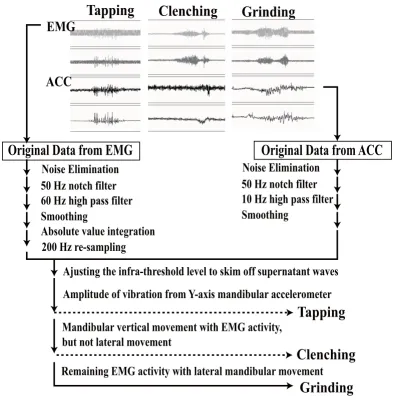 Figure 3 indicates the coincidences of analyzing softwarereactions and voluntary awaking jaw movements