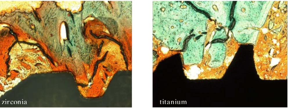 Figure 2Micrograph showing matrix-rich regeneration tissue (orange) between the implant and bone (green)Micrograph showing matrix-rich regeneration tissue (orange) between the implant and bone (green)